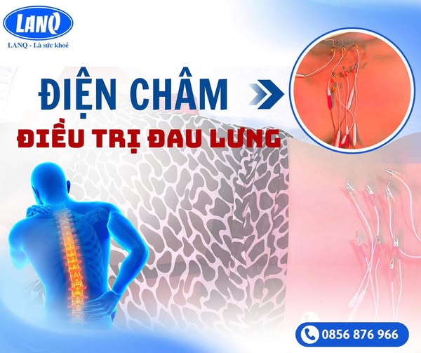 ĐIỆN CHÂM ĐIỀU TRỊ ĐAU LƯNG